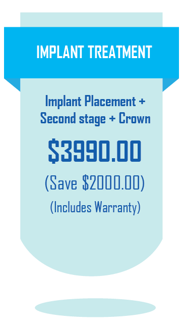 Implant treatment implant treatment dentist Yokine