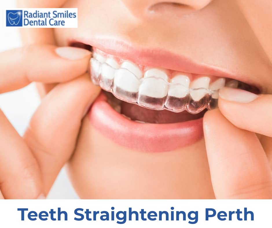 Quick teeth straightening perth