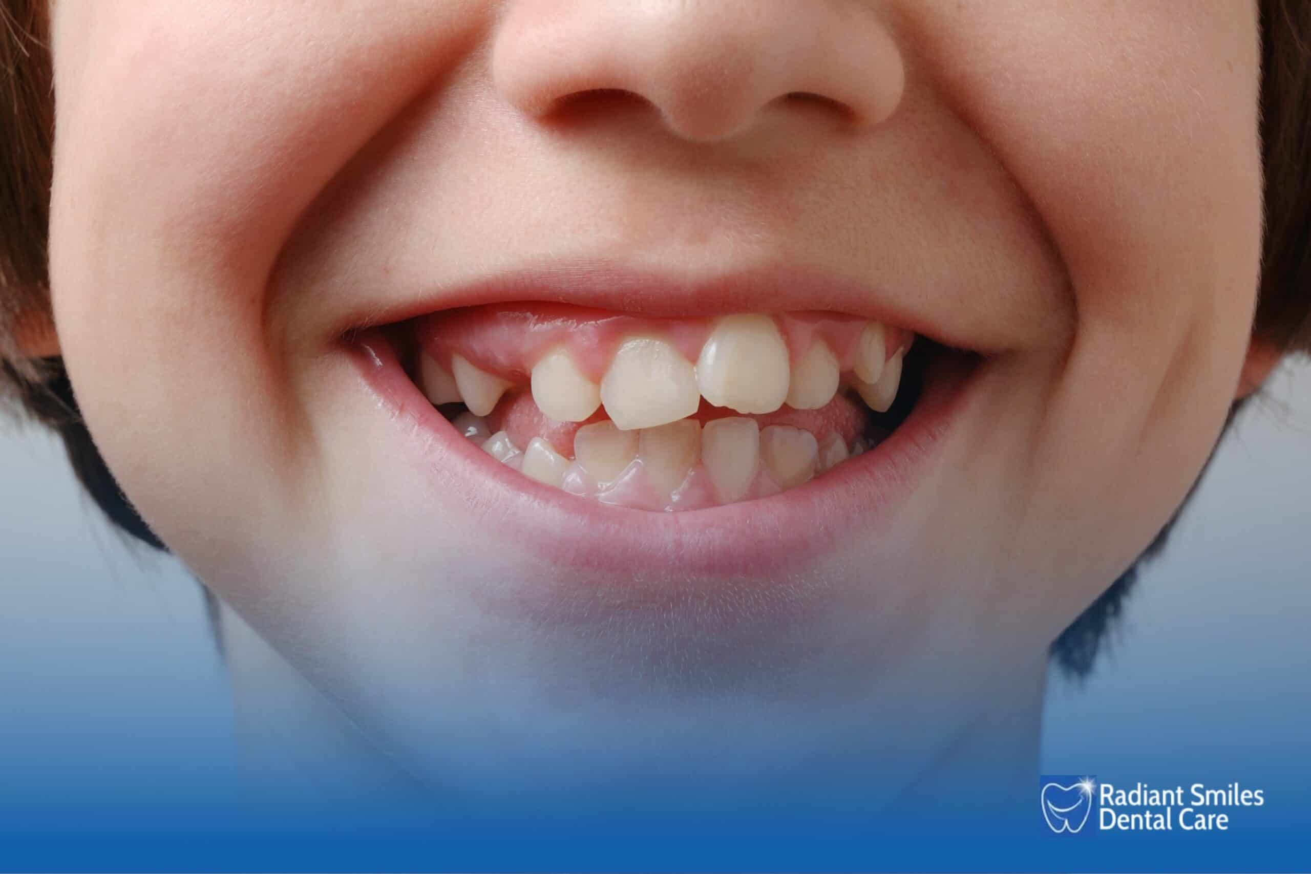 Can Shark Teeth Cause Complications If Untreated