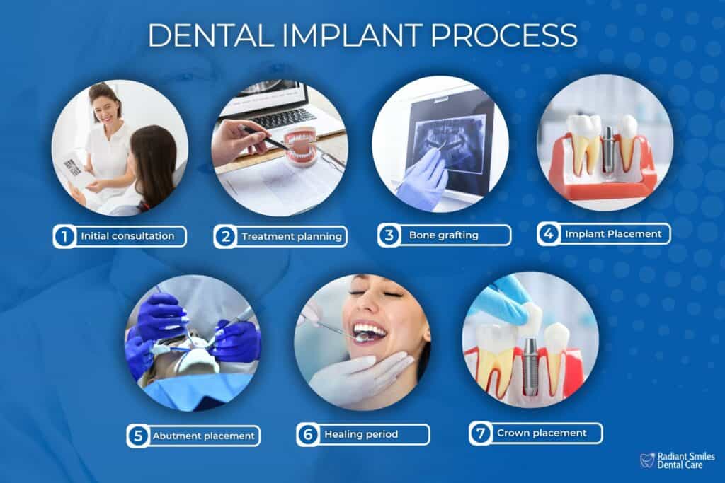 Dental Implant Process