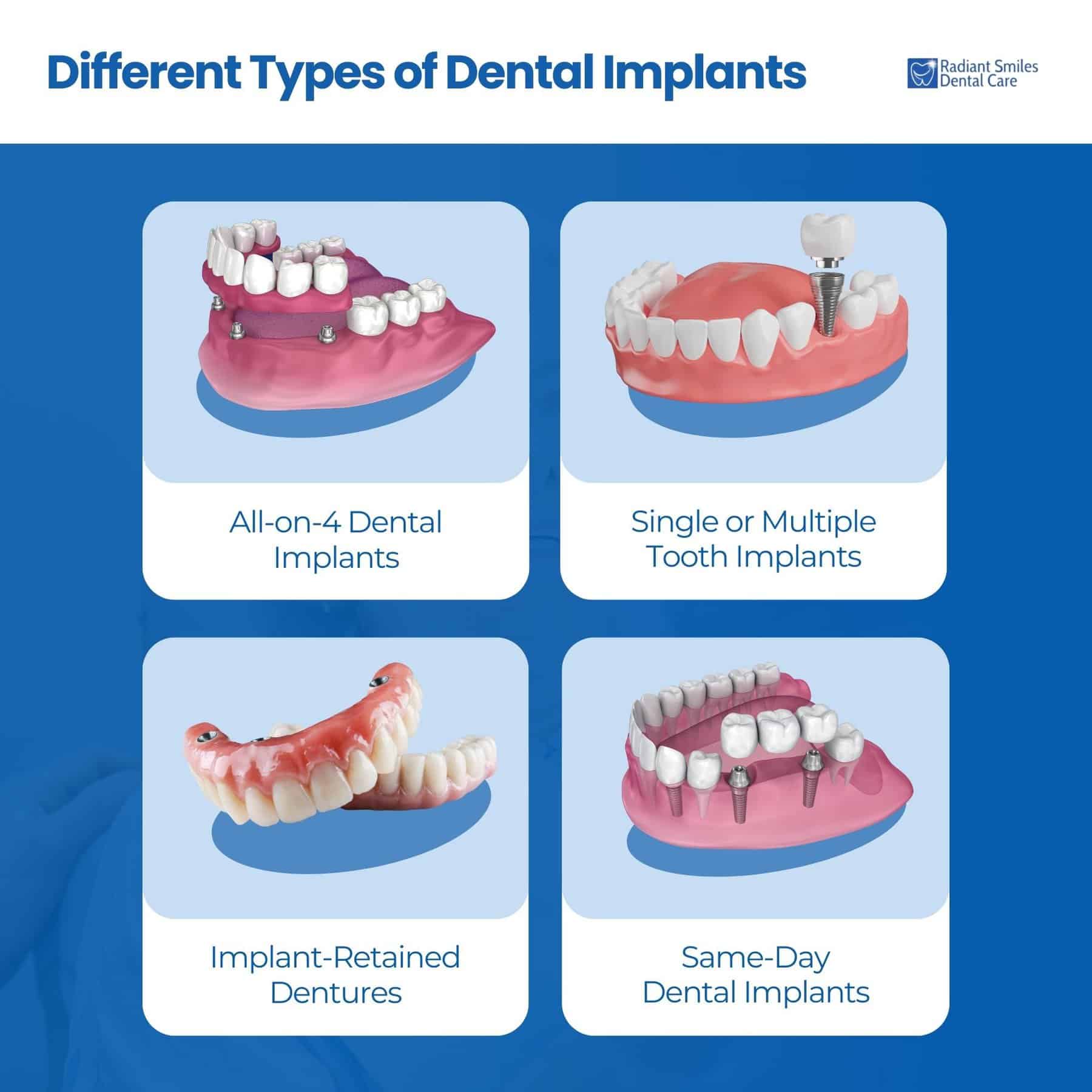 Different Types of Dental Implants