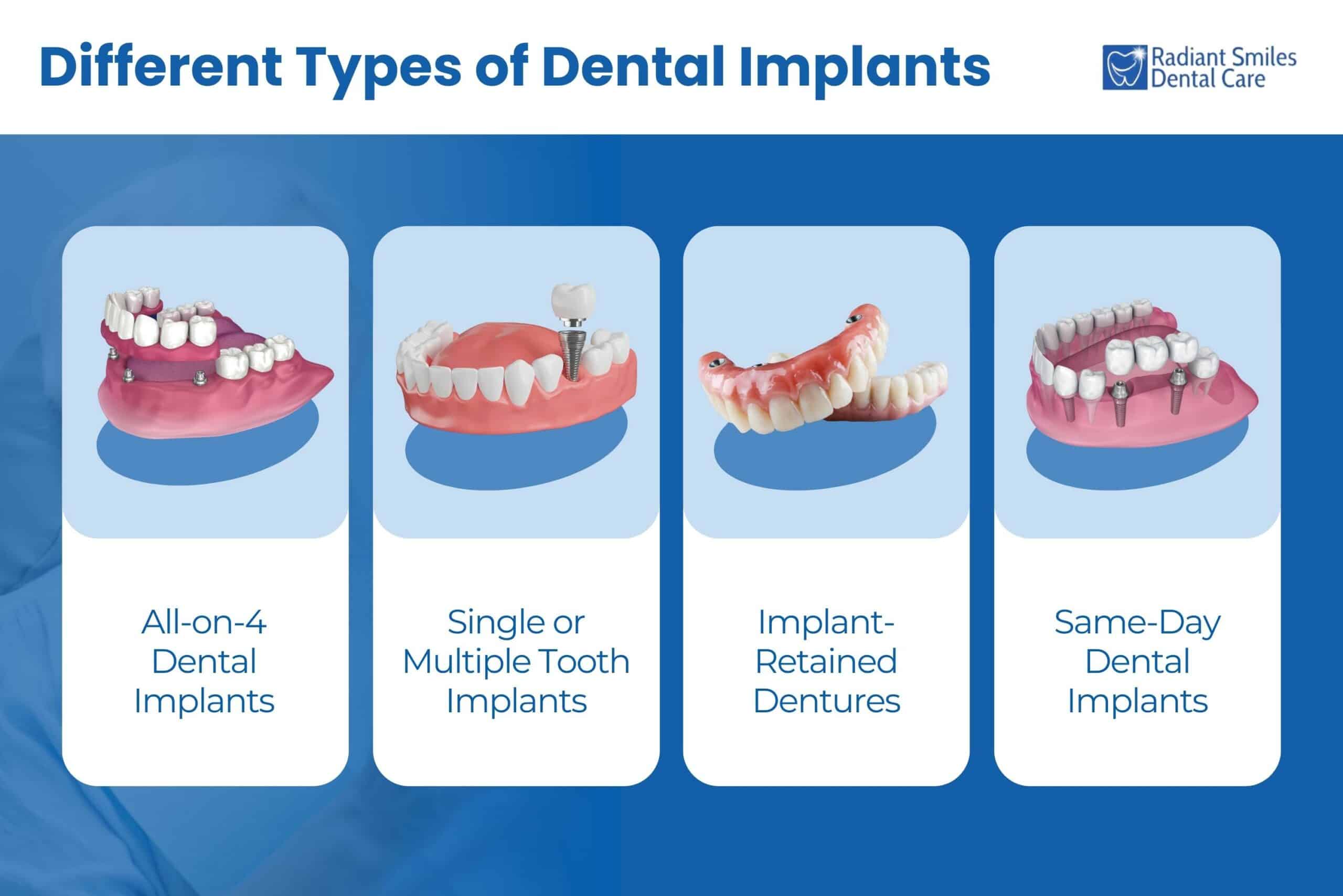 Different Types of Dental Implants