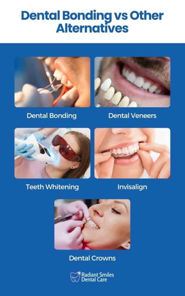 dental bonding versus alternative treatments