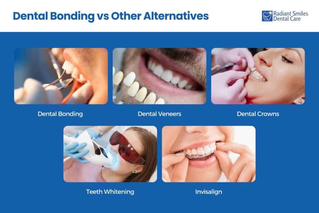 dental bonding vs other alternatives