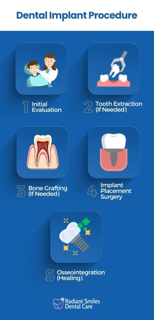 dental implant procedure