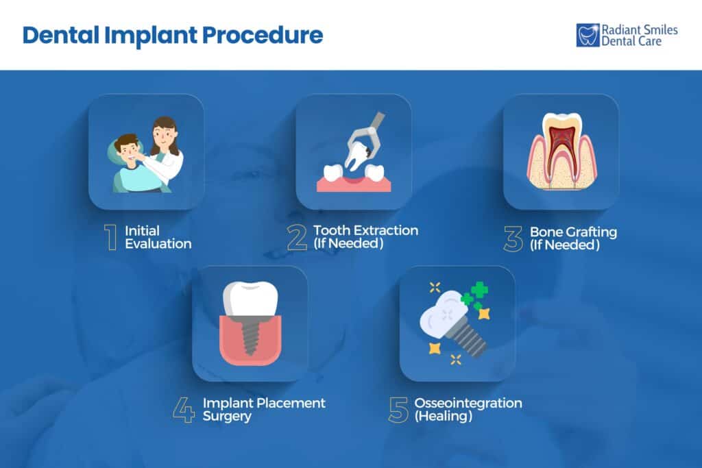 dental implant procedure steps
