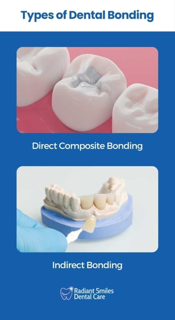 different forms of dental bonding