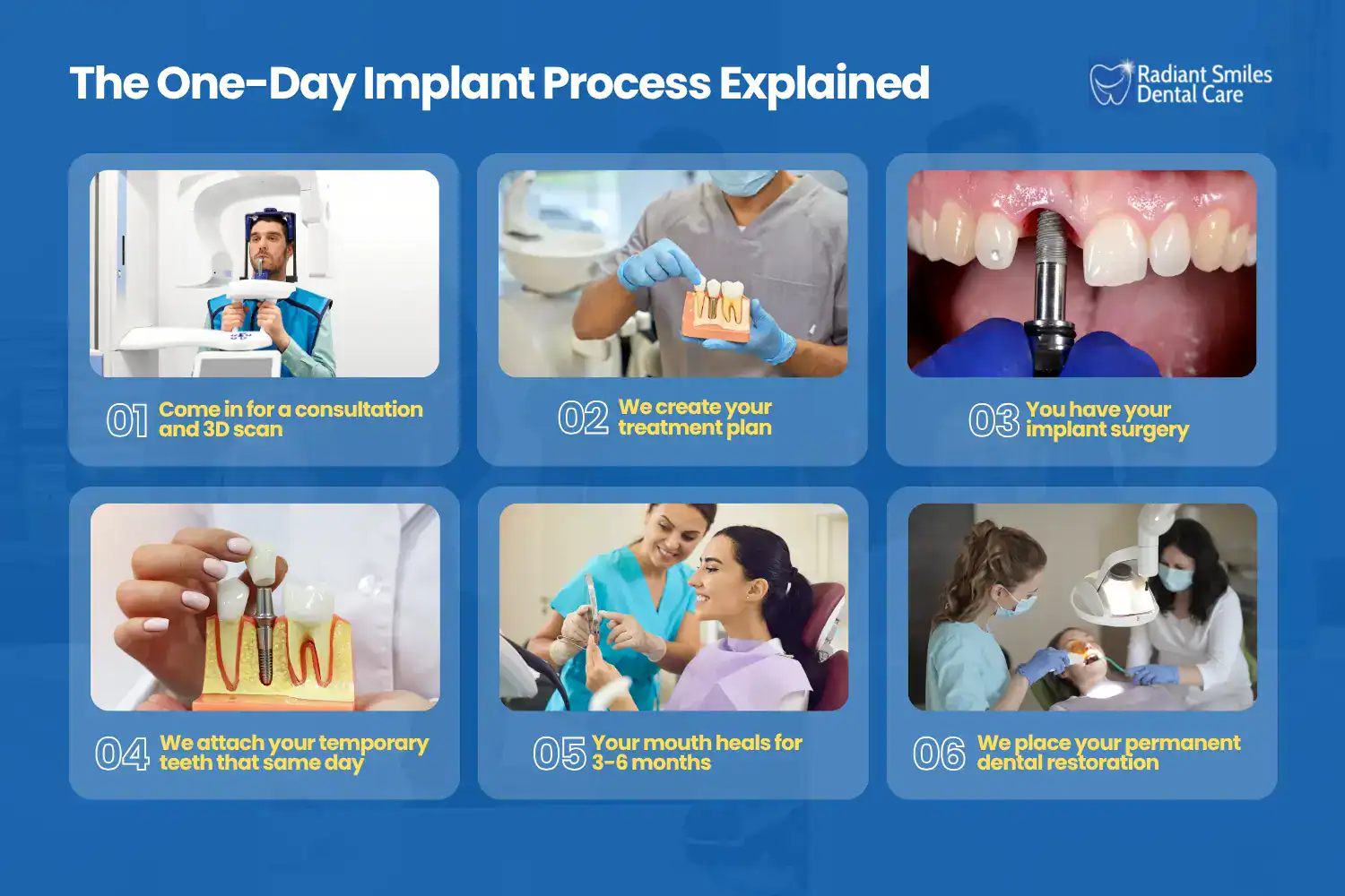 how does the one day implant process actually work
