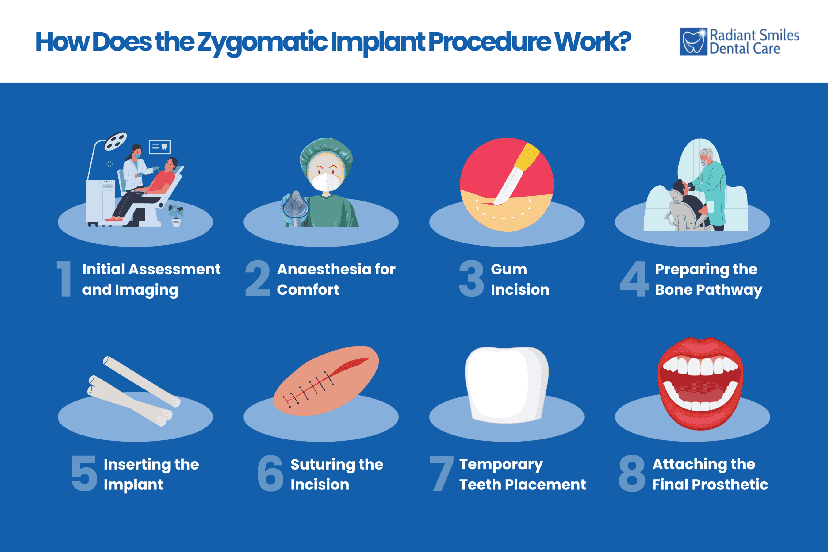 how does the zygomatic implant procedure work