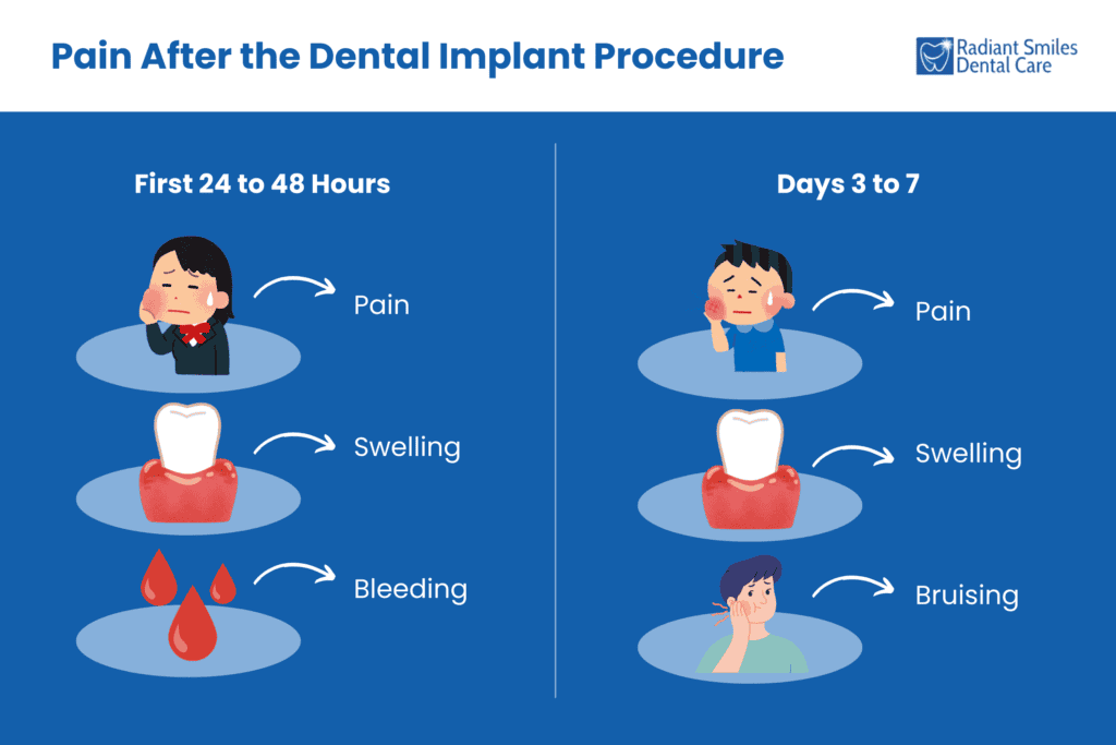 pain after the dental implant procedure