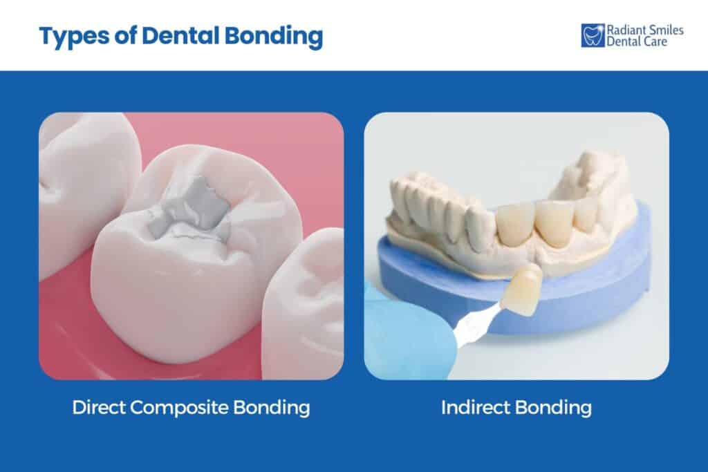 types of dental bonding