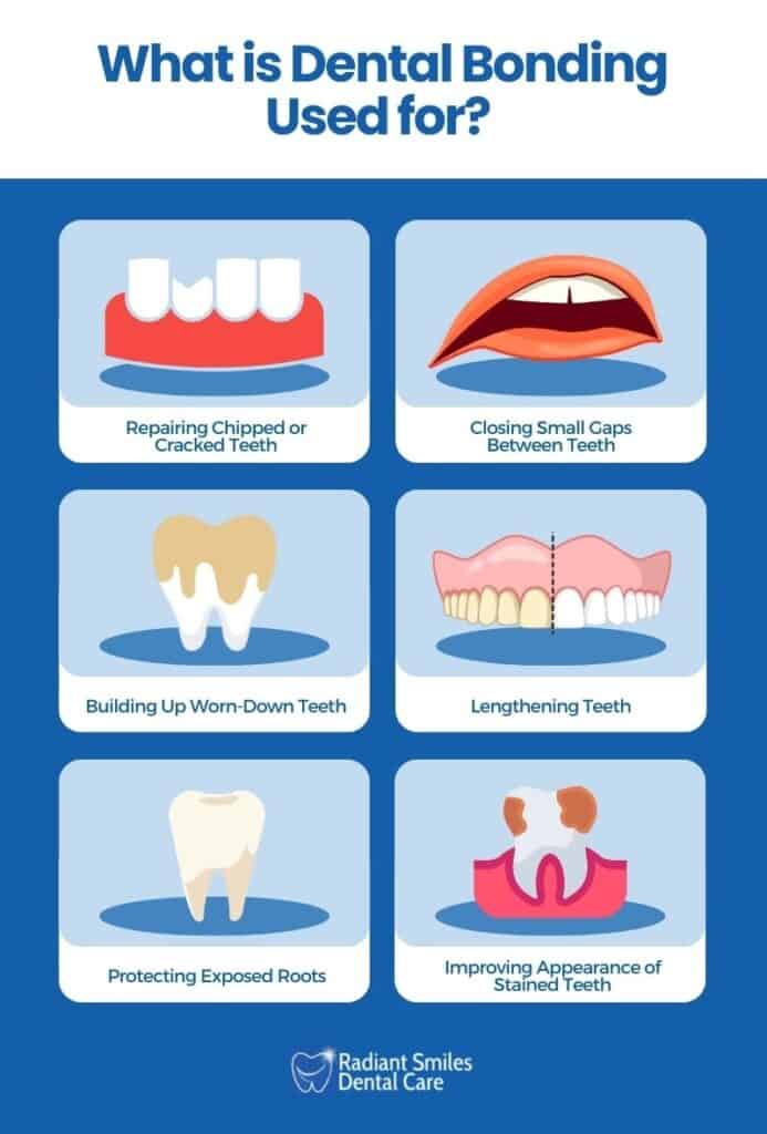 uses of dental bonding