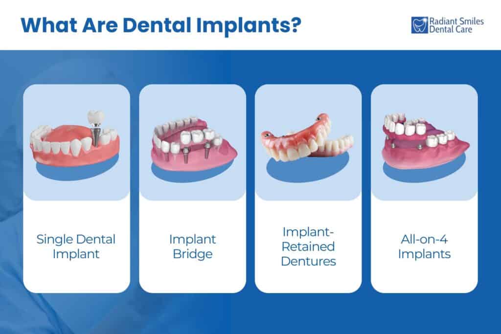 what are dental implants