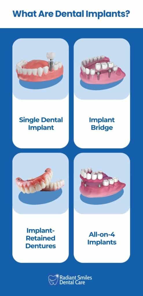 what are tooth implants