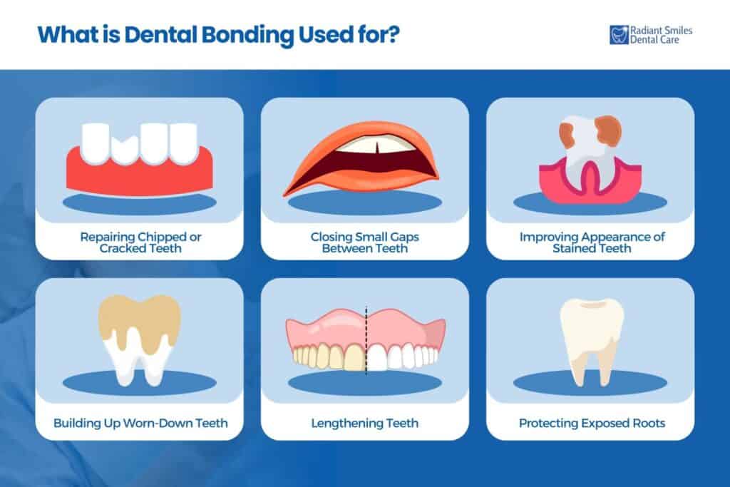 what is dental bonding used for