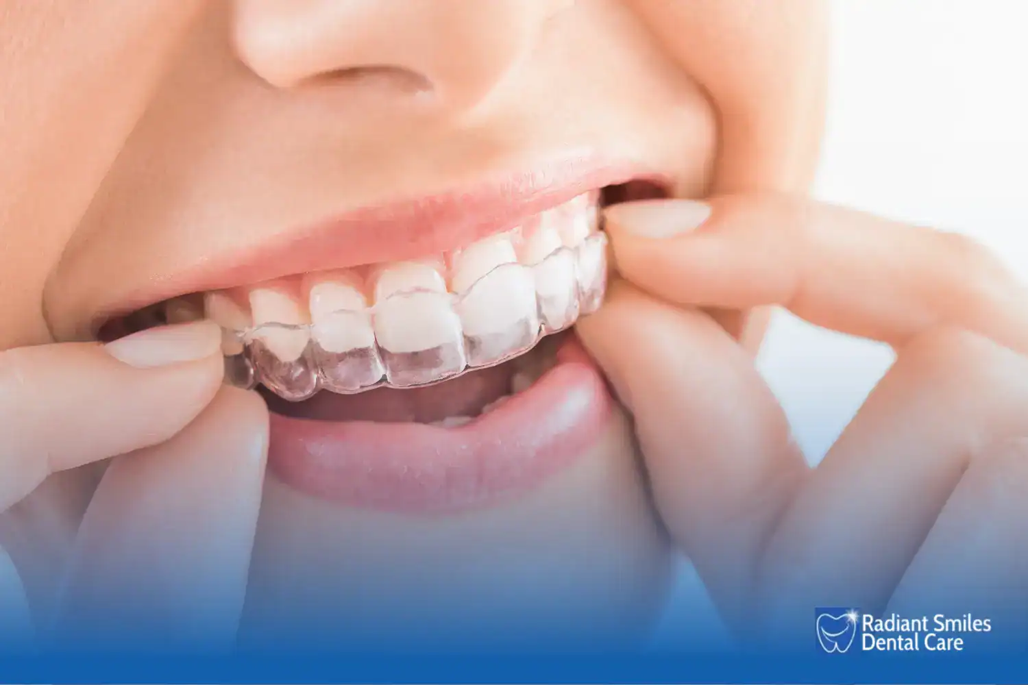 why is cleaning different from just rinsing your aligners