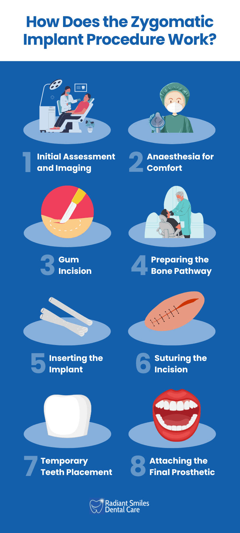 zygomatic implant procedure work